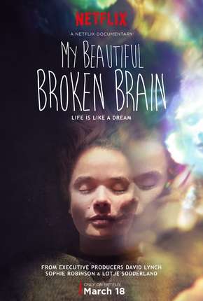 My Beautiful Broken Brain Torrent